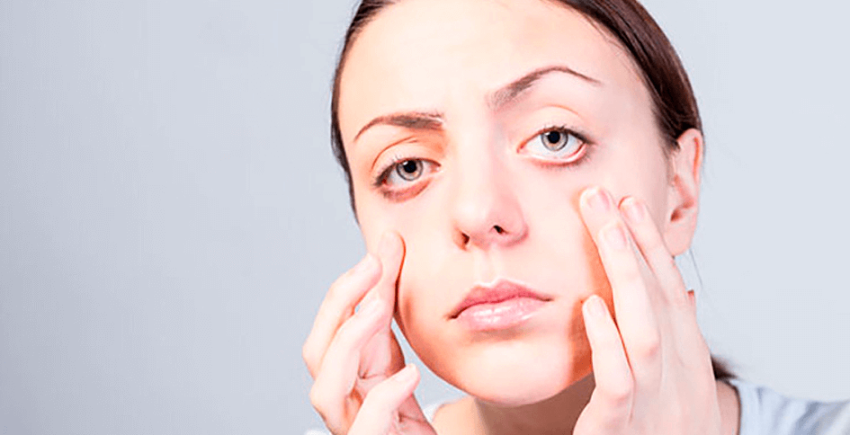 ¿Qué causa la piel flácida?